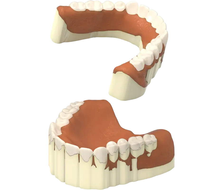 3D Systems NextDent 300